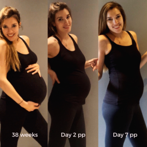 Uterine involution and postpartum bump changes